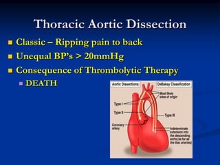 Thoracic Aortic Dissection
 Classic – Ripping pain to back
 Unequal BP’s > 20mmHg
 Consequence of Thrombolytic Therapy
 DEATH
 