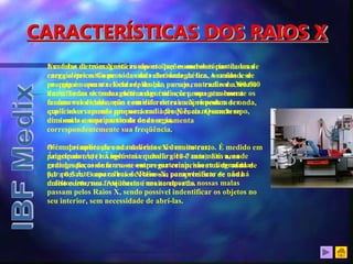 Um feixe de raios X está composto por numerosas partículas de
energia que estão providas da velocidade da luz. A unidade de
energia é o quanta. Esta explicação parece contradizer a teoria
da natureza eletromagnética das radiações, mas atualmente os
fenômenos de absorção e emissão de raios X só podem ser
explicados supondo que uma radiação X é, ao mesmo tempo,
uma onda e uma partícula de energia.
Além das aplicações na medicina existem outras,
principalmente na indústria metalúrgica e automotiva, onde
grandes peças de ferro ou outros materiais, são radiografadas
por possantes aparelhos de Raios-X, para verificar se não há
defeitos internos. Até mesmo nos aeroportos nossas malas
passam pelos Raios X, sendo possível indentificar os objetos no
seu interior, sem necessidade de abrí-las.
As ondas eletromagnéticas são oscilações ondulatórias de uma
carga elétrica. Como toda onda eletromagnética, os raios x se
propagam com a velocidade da luz, ou seja, na razão de 300.000
km/s. Todas as ondas eletromagnéticas se propagam com a
mesma velocidade, mas com diferentes comprimentos de onda,
que é inversamente proporcional à freqüência. Quando se
diminui o comprimento de onda se aumenta
correspondentemente sua freqüência.
O comprimento de onda dos raios X é muito curto. É medido em
Ângstrom (Å) (1 Ângstrom equivale a 10-7 mm). Em uma
radiografia comum usa-se empregar comprimentos de onda de
0,1 a 0,5 Å. Como os raios X têm um comprimento de onda
muito curto, sua freqüência é muito elevada.
CARACTERÍSTICAS DOS RAIOS X
 