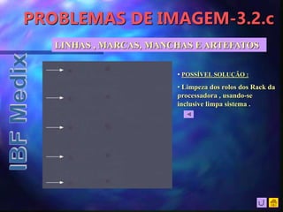 PROBLEMAS DE IMAGEM-3.2.c
LINHAS , MARCAS, MANCHAS E ARTEFATOS
• POSSÍVEL SOLUÇÃO :
• Limpeza dos rolos dos Rack da
processadora , usando-se
inclusive limpa sistema .
 