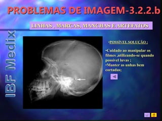PROBLEMAS DE IMAGEM-3.2.2.b
•POSSÍVEL SOLUÇÃO :
•Cuidado ao manipular os
filmes ,utilizando-se quando
possível luvas ;
•Manter as unhas bem
cortadas;
LINHAS , MARCAS, MANCHAS E ARTEFATOS
 
