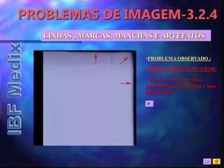 PROBLEMAS DE IMAGEM-3.2.4
•PROBLEMA OBSERVADO :
•BORDAS NEGRAS NO FILME
• Cantos e bordas do filme
apresentam escurecimento e base
fog alterada ;
LINHAS , MARCAS, MANCHAS E ARTEFATOS
 