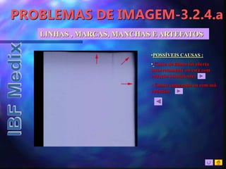 PROBLEMAS DE IMAGEM-3.2.4.a
•POSSÍVEIS CAUSAS :
• Caixa de filmes foi aberta
incorretamente ou está com
vedação insuficiente;
• Chassi empenado ou com má
vedação;
LINHAS , MARCAS, MANCHAS E ARTEFATOS
 