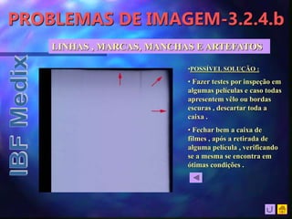 PROBLEMAS DE IMAGEM-3.2.4.b
•POSSÍVEL SOLUÇÃO :
• Fazer testes por inspeção em
algumas películas e caso todas
apresentem vêlo ou bordas
escuras , descartar toda a
caixa .
• Fechar bem a caixa de
filmes , após a retirada de
alguma película , verificando
se a mesma se encontra em
ótimas condições .
LINHAS , MARCAS, MANCHAS E ARTEFATOS
 