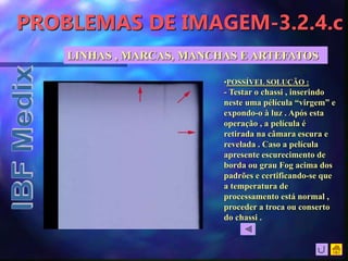 PROBLEMAS DE IMAGEM-3.2.4.c
•POSSÍVEL SOLUÇÃO :
- Testar o chassi , inserindo
neste uma pélícula “virgem” e
expondo-o à luz . Após esta
operação , a película é
retirada na câmara escura e
revelada . Caso a película
apresente escurecimento de
borda ou grau Fog acima dos
padrões e certificando-se que
a temperatura de
processamento está normal ,
proceder a troca ou conserto
do chassi .
LINHAS , MARCAS, MANCHAS E ARTEFATOS
 
