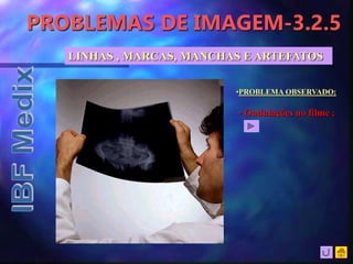 PROBLEMAS DE IMAGEM-3.2.5
LINHAS , MARCAS, MANCHAS E ARTEFATOS
•PROBLEMA OBSERVADO:
• Ondulações no filme ;
 