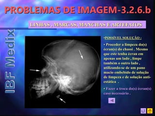 PROBLEMAS DE IMAGEM-3.2.6.b
LINHAS , MARCAS, MANCHAS E ARTEFATOS
•POSSÍVEL SOLUÇÃO :
• Proceder a limpeza do(s)
écran(s) do chassi . Mesmo
que este tenha écran em
apenas um lado , limpe
também o outro lado ,
utilizando-se de um pano
macio embebido de solução
de limpeza e de solução anti-
estática .
• Fazer a troca do(s) écran(s)
caso necessário .
 