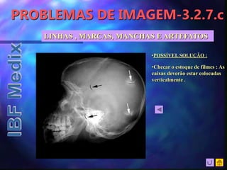 PROBLEMAS DE IMAGEM-3.2.7.c
•Checar o estoque de filmes : As
caixas deverão estar colocadas
verticalmente .
•POSSÍVEL SOLUÇÃO :
LINHAS , MARCAS, MANCHAS E ARTEFATOS
 