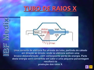 TUBO DE RAIOS X
Uma corrente de elétrons flui através do tubo, partindo do cátodo
em direção ao ânodo, onde os elétrons sofrem uma
brusca desaceleração , com conseqüente perda de energia. Parte
desta energia será convertida em calor e uma pequena porcentagem
resultará na
produção dos raios X.
 