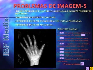 PROBLEMAS DE IMAGEM-5
• FILME ÚMIDO (PELÍCULAS VIRGENS GRUDADAS) E IMAGEM POSTERIOR
MANCHADA .
• DEPÓSITOS NA SUPERFÍCIE DO FILME.
• SUPERFÍCIE DO FILME ENEGRECIDA COM FAIXAS PRATEADAS .
• SUPERFÍCIE DO FILME MANCHADA .
POSSÍVEIS CAUSAS :
• Alto grau de umidade relativa do ar
na câmara escura - (Ver quadro) ;
• Superfície do cilindro do rack do
revelador está suja pela prata do revelador ;
• As superfície dos racks do fixador,
lavagem e secador podem estar sujas ;
• Água de lavagem não está limpa ;
• Bandeja de alimentação suja ;
• Revelador contaminado ;
• Manipulação das Películas com as
mãos úmidas ;
Próximo problema
 