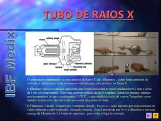 TUBO DE RAIOS X
Os principais componentes de uma ampola de Raios X são : filamento , como fonte emissora de
elétrons, e um anteparo onde os mesmos irão interagir para produzir os Raios X .
O filamento emissor (cátodo), apresenta uma forma helicoidal de aproximadamente 0,2 mm e cerca
de 1 cm de comprimento . Para uma corrente elétrica de até 5 Ampères fluindo no mesmo, teremos
uma temperatura de aproximadamente 3.370°C , o que explica a razão de usar-se Tungstênio como
material constituinte, devido a este apresentar alto ponto de fusão .
O Filamento (Cátodo - Negativo) e o anteparo (ânodo - Positivo) , estão envoltos por uma estrutura de
vidro resistente a calor e pressão , chamada Ampola . Esta é envolvida em Ferro e Alumínio e em uma
carcaça de Chumbo de 3 a 4 mm de espessura , para evitar a fuga de radiação.
 