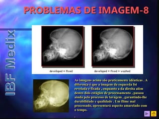 PROBLEMAS DE IMAGEM-8
As imagens acima são praticamente idênticas . A
diferença é que a imagem da esquerda foi
revelada e fixada , enquanto a da direita além
destes dois estágios de processamento , passou
ainda pelo processo de lavagem , garantindo-lhe
durabilidade e qualidade . Um filme mal
processado, apresentará aspecto amarelado com
o tempo.
.
 