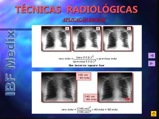 TÉCNICAS RADIOLÓGICAS
APLICAÇÃO DO MAS
 