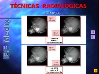 TÉCNICAS RADIOLÓGICAS
EXEMPLOS
 