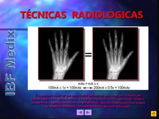 TÉCNICAS RADIOLÓGICAS
É importante observar que uma técnica aplicada em um exame será definida por
fatores como o mA aplicado versos o tempo de exposição. No exemplo acima , temos a
mesma técnica aplicada usando-se um mA diferente , porém compensando com tempos
de exposição diferentes . O resultado final é um fator mAs igual .
 