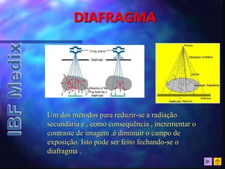 DIAFRAGMA
Um dos métodos para reduzir-se a radiação
secundária e , como consequência , incrementar o
contraste de imagem ,é diminuir o campo de
exposição. Isto pode ser feito fechando-se o
diafragma .
 