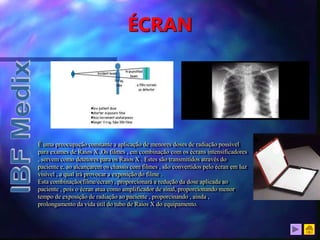ÉCRAN
É uma preocupação constante a aplicação de menores doses de radiação possível
para exames de Raios X .Os filmes , em combinação com os écrans intensificadores
, servem como detetores para os Raios X . Estes são transmitidos através do
paciente e, ao alcançarem os chassis com filmes , são convertidos pelo écran em luz
visível , a qual irá provocar a exposição do filme .
Esta combinação(filme/écran) , proporcionará a redução da dose aplicada ao
paciente , pois o écran atua como amplificador de sinal, proporcionando menor
tempo de exposição de radiação ao paciente , proporcinando , ainda ,
prolongamento da vida útil do tubo de Raios X do equipamento.
 