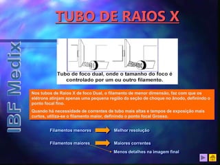 TUBO DE RAIOS X
Nos tubos de Raios X de foco Dual, o filamento de menor dimensão, faz com que os
elétrons atinjam apenas uma pequena região da seção de choque no ânodo, definindo o
ponto focal fino.
Quando há necessidade de correntes de tubo mais altas e tempos de exposição mais
curtos, utiliza-se o filamento maior, definindo o ponto focal Grosso.
Filamentos menores Melhor resolução
Filamentos maiores Maiores correntes
Menos detalhes na imagem final
 