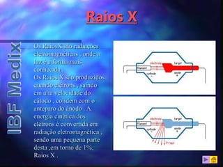 Raios X
Os RaiosX são radiações
eletromagnéticas , onde a
luz é a forma mais
conhecida .
Os Raios X são produzidos
quando elétrons , saindo
em alta velocidade do
cátodo , colidem com o
anteparo do ânodo . A
energia cinética dos
elétrons é convertida em
radiação eletromagnética ,
sendo uma pequena parte
desta ,em torno de 1%,
Raios X .
 
