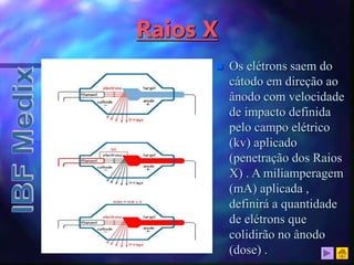 Raios X
 Os elétrons saem do
cátodo em direção ao
ânodo com velocidade
de impacto definida
pelo campo elétrico
(kv) aplicado
(penetração dos Raios
X) . A miliamperagem
(mA) aplicada ,
definirá a quantidade
de elétrons que
colidirão no ânodo
(dose) .
 