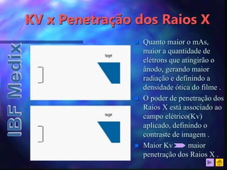 KV x Penetração dos Raios X
 Quanto maior o mAs,
maior a quantidade de
elétrons que atingirão o
ânodo, gerando maior
radiação e definindo a
densidade ótica do filme .
 O poder de penetração dos
Raios X está associado ao
campo elétrico(Kv)
aplicado, definindo o
contraste de imagem .
 Maior Kv maior
penetração dos Raios X .
 