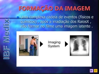 FORMAÇÃO DA IMAGEM
 Uma complexa cadeia de eventos (físicos e
químicos) , após a irradiação dos RaiosX ,
irão formar no filme uma imagem latente .
 