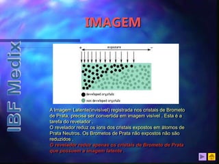IMAGEM
A Imagem Latente(invisível) registrada nos cristais de Brometo
de Prata, precisa ser convertida em imagem visível . Esta é a
tarefa do revelador .
O revelador reduz os íons dos cristais expostos em átomos de
Prata Neutros. Os Brometos de Prata não expostos não são
reduzidos .
O revelador reduz apenas os cristais de Brometo de Prata
que possuem a imagem latente .
 