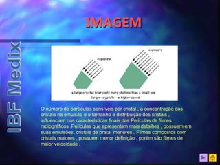 IMAGEM
O número de partículas sensíveis por cristal , a concentração dos
cristais na emulsão e o tamanho e distribuição dos cristais ,
influenciam nas características finais das Películas de filmes
radiográficos .Películas que apresentam mais detalhes , possuem em
suas emulsões, cristais de prata menores . Filmes compostos com
cristais maiores , possuem menor definição , porém são filmes de
maior velocidade .
 