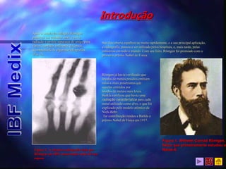 Após o estudo da radiação, Röntgen
publicou um trabalho sobre a nova
radiação e enviou separatas do artigo para
vários cientistas influentes da época,
acompanhada de algumas radiografias
(Fig. 2).
Figura 2. A clássica radiografia feita por
Röntgen em 1895, mostrando a mão de sua
esposa.
Introdução
Sua descoberta espalhou-se muito rapidamente, e a sua principal aplicação,
a radiografia, passou a ser utilizada pelos hospitais, e, mais tarde, pelas
indústrias em todo o mundo. Com seu feito, Röntgen foi premiado com o
primeiro prêmio Nobel de Física.
Röntgen já havia verificado que
ânodos de metais pesados emitiam
raios-x mais penetrantes que
aqueles emitidos por
ânodos de metais mais leves.
Barkla verificou que havia uma
radiação característica para cada
metal utilizado como alvo, o que foi
explicado pelo modelo atômico de
Niels Bohr.
Tal contribuição rendeu a Barkla o
prêmio Nobel de Física em 1917.
Figura 1. Wilhelm Conrad Röntgen,
físico que primeiramente estudou os
Raios-X.
 