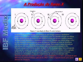 A Produção de Raios-X
Os Raios-X são gerados quando uma partícula de alta energia cinética é rapidamente
desacelerada. O método mais utilizado para produzir raios-X é fazendo com que um elétron
de alta energia (gerado no cátodo do tubo catódico) colida com um alvo metálico (ânodo).
Na figura acima, analisamos o fenômeno a nível atômico. Quando esse elétron atinge o alvo
(I), um elétron da camada K de um átomo do material é liberado na forma de fotoelétron
(II), fazendo com que haja uma vacância nessa camada. Para ocupar o espaço deixado por
esse elétron, um outro elétron de uma camada mais externa passa à camada K (III),
liberando energia na forma de um fóton de Raios-X (IV). A energia desse fóton corresponde
à diferença de energia entre as duas camadas. Durante os primeiros estudos sobre a geração
de Raios-X, foi percebido que ao aumentar a diferença de potencial entre os terminais,
aumenta-se a intensidade e a faixa de comprimentos de onda produzidos pelo tubo .
Materiais utilizados em tubos de RaiosX , como o Molibdênio e o Cobre , precisam de uma
diferença de potencial mínima aplicada de 29KV e 8,9KV respectivamente para ejetar
elétrons da camada K .
 