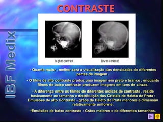 CONTRASTE
• Quanto maior , melhor será a visualização das densidades de diferentes
partes da imagem .
• O filme de alto contraste produz uma imagem em preto e branco , enquanto
filmes de baixo contraste produzem imagens em tons de cinzas.
• A diferença entre os filmes de diferentes índices de contraste , reside
basicamente no tamanho e distribuição dos Cristais de Haleto de Prata :
Emulsões de alto Contraste - grãos de Haleto de Prata menores e dimensão
relativamente uniforme;
•Emulsões de baixo contraste : Grãos maiores e de diferentes tamanhos.
 