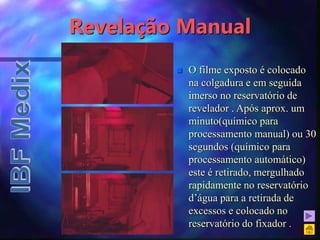Revelação Manual
 O filme exposto é colocado
na colgadura e em seguida
imerso no reservatório de
revelador . Após aprox. um
minuto(químico para
processamento manual) ou 30
segundos (químico para
processamento automático)
este é retirado, mergulhado
rapidamente no reservatório
d’água para a retirada de
excessos e colocado no
reservatório do fixador .
 