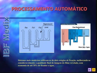 PROCESSAMENTO AUTOMÁTICO
Sistemas mais modernos utilizam-se de dois estágios de fixação, melhorando-se
consideravelmente a qualidade final de imagem do filme revelado, com
economia de até 35% de fixador e água .
 