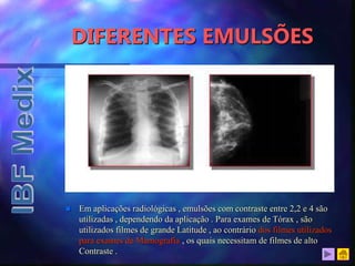 DIFERENTES EMULSÕES
 Em aplicações radiológicas , emulsões com contraste entre 2,2 e 4 são
utilizadas , dependendo da aplicação . Para exames de Tórax , são
utilizados filmes de grande Latitude , ao contrário dos filmes utilizados
para exames de Mamografia , os quais necessitam de filmes de alto
Contraste .
 