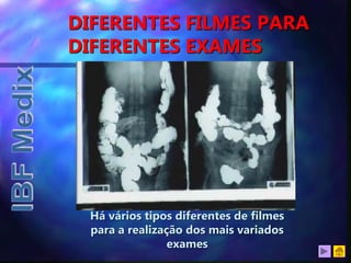 DIFERENTES FILMES PARA
DIFERENTES EXAMES
Há vários tipos diferentes de filmes
para a realização dos mais variados
exames
 