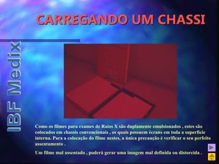CARREGANDO UM CHASSI
Como os filmes para exames de Raios X são duplamente emulsionados , estes são
colocados em chassis convencionais , os quais possuem écrans em toda a superfície
interna. Para a colocação do filme nestes, a única precaução é verificar o seu perfeito
assentamento .
Um filme mal assentado , poderá gerar uma imagem mal definida ou distorcida .
 