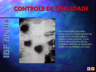 CONTROLE DE QUALIDADE
DEVEMOS TER CUIDADOS
ESPECIAIS AO COLOCARMOS UM
FILME NOS CHASSIS, APÓS A
LIMPEZA DOS ÉCRANS . CASO
ESTES NÃO ESTEJAM SECOS ,
PODERÃO PROVOCAR MANCHAS,
COMO AS DA FIGURAAO LADO .
 