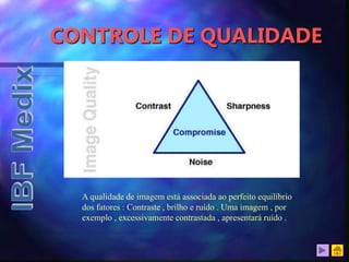 CONTROLE DE QUALIDADE
A qualidade de imagem está associada ao perfeito equilíbrio
dos fatores : Contraste , brilho e ruído . Uma imagem , por
exemplo , excessivamente contrastada , apresentará ruído .
 
