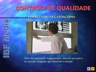 CONTROLE DE QUALIDADE
LIMPEZA DO NEGATOSCÓPIO
Além da limpeza do Negatoscópio , deve-se proceder a
revisão das lâmpadas que iluminam o mesmo .
 