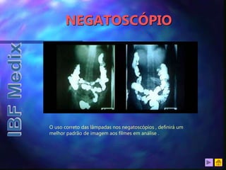 NEGATOSCÓPIO
O uso correto das lâmpadas nos negatoscópios , definirá um
melhor padrão de imagem aos filmes em análise .
 