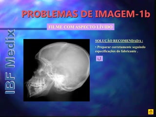 PROBLEMAS DE IMAGEM-1b
FILME COM ASPECTO LÍVIDO
SOLUÇÃO RECOMENDADA :
• Preparar corretamente seguindo
especificações do fabricante .
 