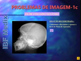 PROBLEMAS DE IMAGEM-1c
FILME COM ASPECTO LÍVIDO
SOLUÇÃO RECOMENDADA :
• Substituir o Revelador e ajustar o
nível de Fluxo de reposição.
 