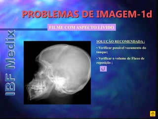 PROBLEMAS DE IMAGEM-1d
FILME COM ASPECTO LÍVIDO
SOLUÇÃO RECOMENDADA :
• Verificar possível vazamento do
tanque;
• Verificar o volume de Fluxo de
reposição ;
 