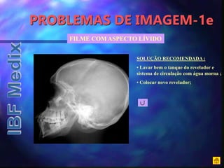 PROBLEMAS DE IMAGEM-1e
FILME COM ASPECTO LÍVIDO
SOLUÇÃO RECOMENDADA :
• Lavar bem o tanque do revelador e
sistema de circulação com água morna ;
• Colocar novo revelador;
 