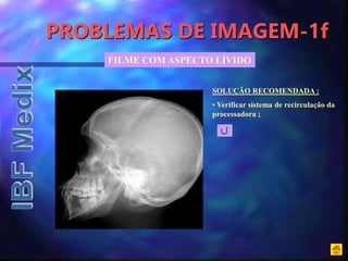 PROBLEMAS DE IMAGEM-1f
FILME COM ASPECTO LÍVIDO
SOLUÇÃO RECOMENDADA :
• Verificar sistema de recirculação da
processadora ;
 