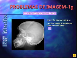 PROBLEMAS DE IMAGEM-1g
FILME COM ASPECTO LÍVIDO
SOLUÇÃO RECOMENDADA :
• Verificar sistema de aquecimento ,
resistência do revelador;
 