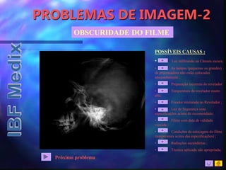 PROBLEMAS DE IMAGEM-2
OBSCURIDADE DO FILME
POSSÍVEIS CAUSAS :
• Luz infiltrando na Câmara escura;
• As tampas (pequenas ou grandes)
da processadora não estão colocadas
adequadamente ;
• Preparação incorreta do revelador
• Temperatura do revelador muito
alta;
• Fixador misturado ao Revelador ;
• Luz de Segurança com
especificações acima do recomendado;
• Filme com data de validade
vencida ;
• Condições de estocagem do filme
(temperatura acima das especificações) ;
• Radiações secundárias ;
• Técnica aplicada não apropriada;
Próximo problema
 