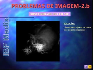 PROBLEMAS DE IMAGEM-2.b
OBSCURIDADE DO FILME
SOLUÇÃO :
• Inspecionar, ajustar ou trocar
caso estejam empenadas .
 
