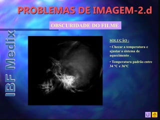 PROBLEMAS DE IMAGEM-2.d
OBSCURIDADE DO FILME
SOLUÇÃO :
• Checar a temperatura e
ajustar o sistema de
aquecimento .
• Temperatura padrão entre
34 °C e 36°C
 