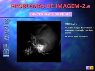 PROBLEMAS DE IMAGEM-2.e
OBSCURIDADE DO FILME
SOLUÇÃO :
• Lavar o tanque do revelador e
sistema de circulação com água
morna .
• Colocar novo revelador;
 