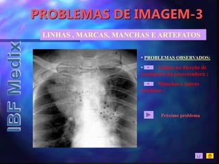 PROBLEMAS DE IMAGEM-3
LINHAS , MARCAS, MANCHAS E ARTEFATOS
• PROBLEMAS OBSERVADOS:
• Linhas na direção de
transporte da processadora ;
• Manchas e outros
artefatos ;
Próximo problema
 